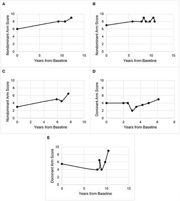 Longitudinal Progression of Essential Tremor: Do Tremor Severity Scores Increase at a Uniform Rate?